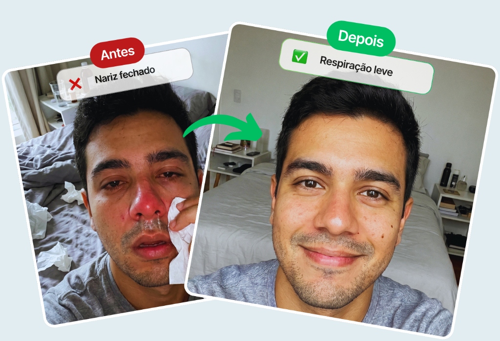 Antes e Depois da Rinite