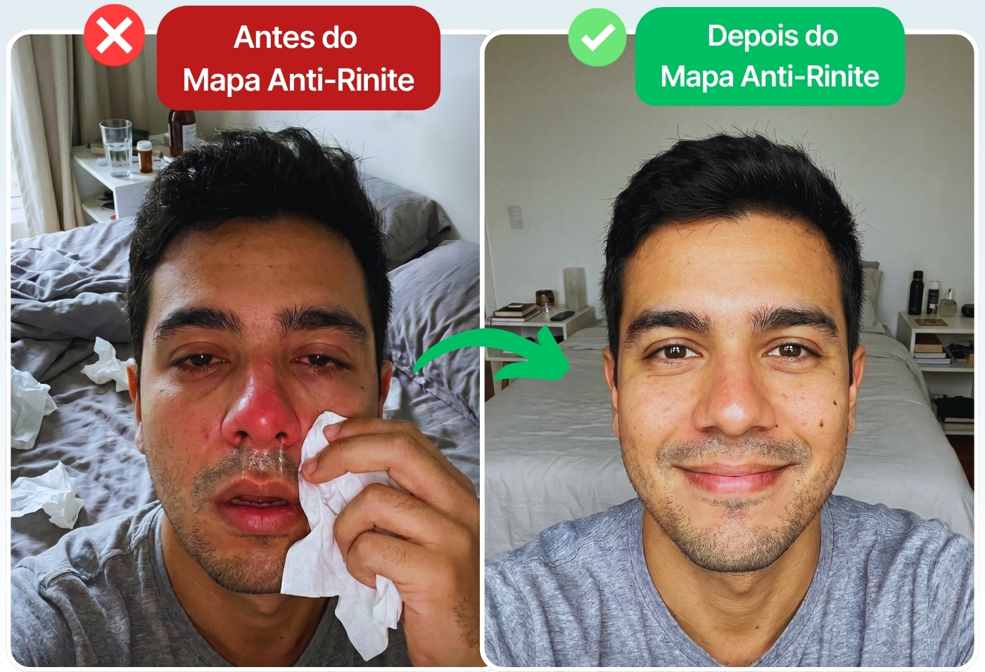 Antes e Depois da Rinite